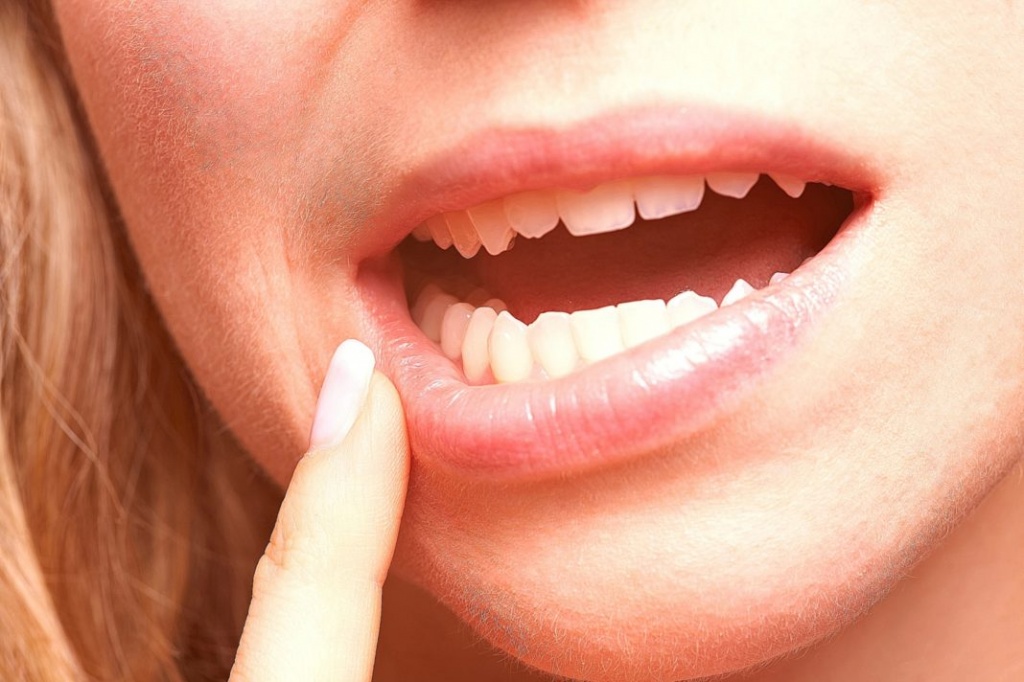 Опухание губ из-за воспалительных процессов